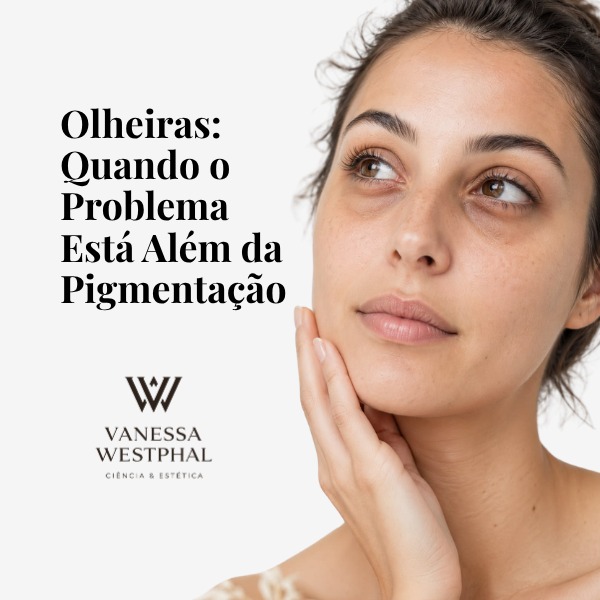Aula Olheiras: Quando o Problema Está Além da Pigmentação