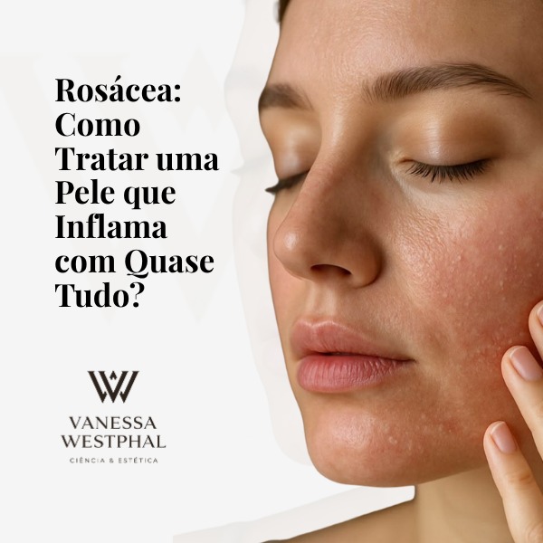 Aula Rosácea